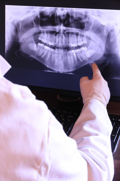 Best Emergency Dentist for Knocked-Out Tooth in Welcome, NC
