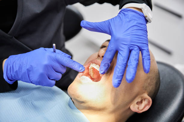 Best Emergency Dental Care for Abscessed Tooth in Welcome, NC